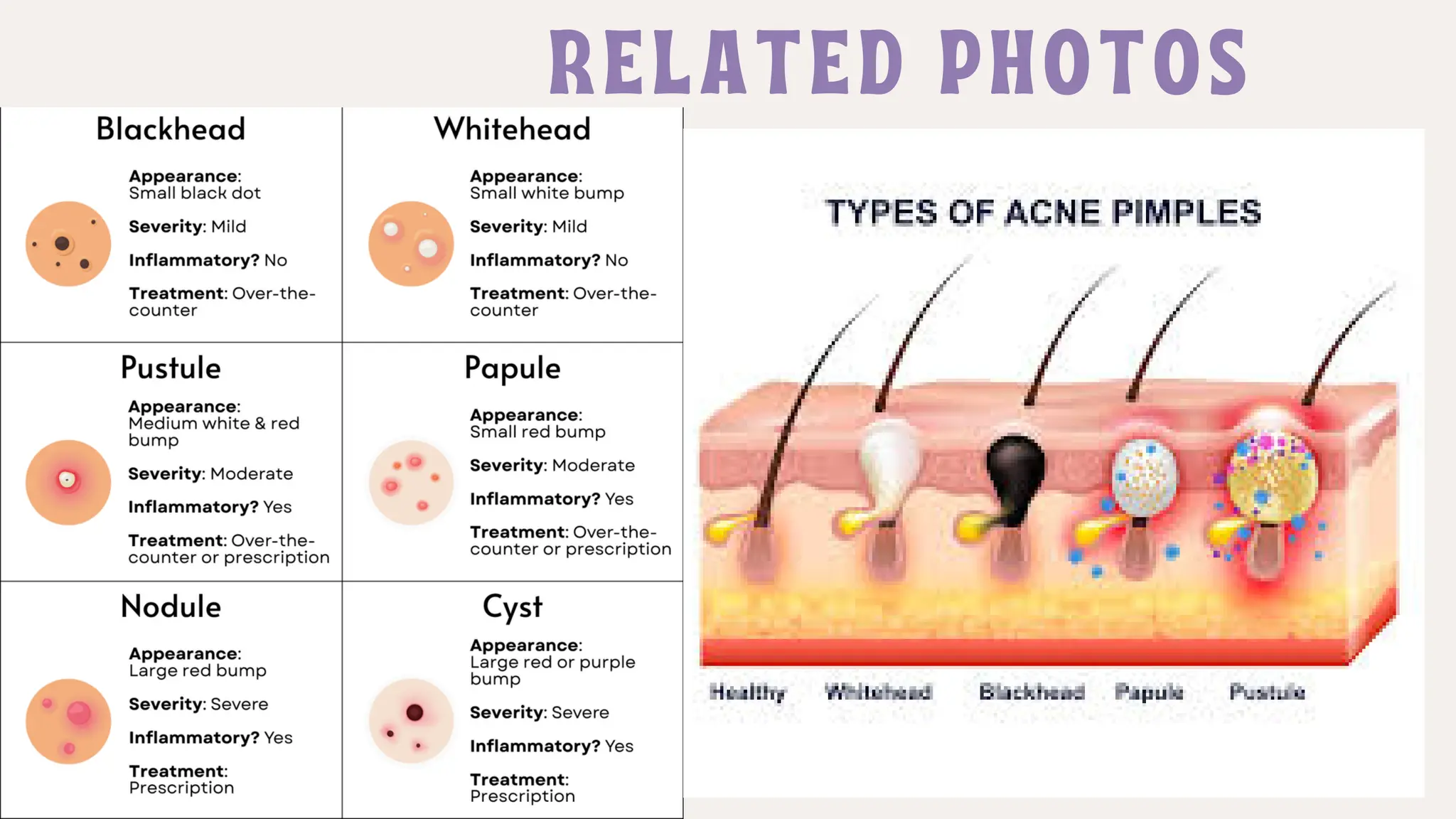 Skin Anatomy of human skin LAYERS OF SKIN Biology Diagrams
