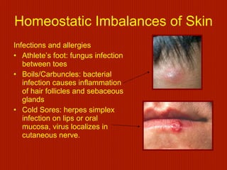 Skin and body membranes | PPT