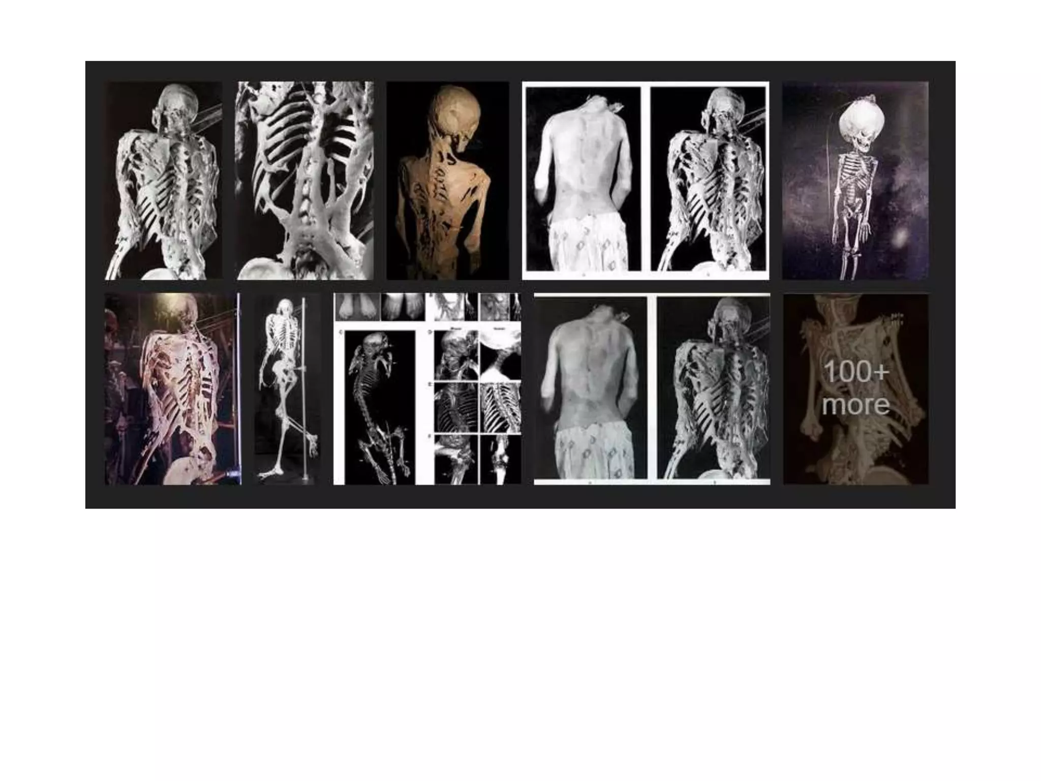 Skin and bone regeneration. 