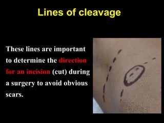 Lines of cleavage
These lines are important
to determine the direction
for an incision (cut) during
a surgery to avoid obvious
scars.
 