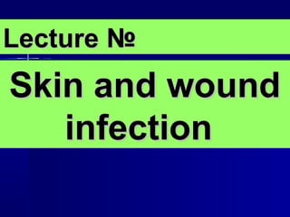 Lecture №
Skin and wound
   infection
 