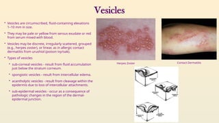 Linear Vesicles Skin_appendages_and_applied anatomy.pptx