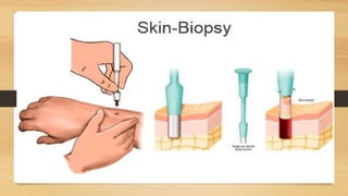 SKIN BIOPSY PPT.pptx