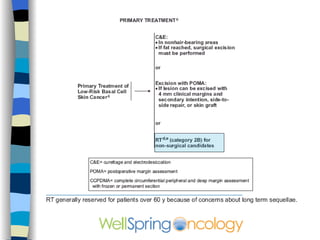 Typical appearance of a well differentiated squamous cancer on the shin called keratoacanthoma 