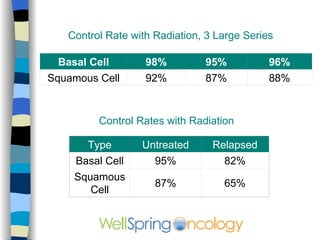 Superficial spreading melanomas in all stages of development. The small early lesions have irregular borders, irregular pigmentation, and   small white areas indicating regression. The largest tumors show an accentuation of all of these features.   