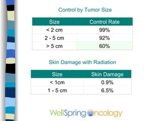 Superficial Spreading Melanoma 