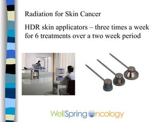 Lentigo Maligna Melanoma  