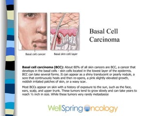 Basal Cell Carcinoma Basal cell carcinoma (BCC):  About 80% of all skin cancers are BCC, a cancer that develops in the basal cells - skin cells located in the lowest layer of the epidermis. BCC can take several forms. It can appear as a shiny translucent or pearly nodule, a sore that continuously heals and then re-opens, a pink slightly elevated growth, reddish irritated patches of skin, or a waxy scar.  Most BCCs appear on skin with a history of exposure to the sun, such as the face, ears, scalp, and upper trunk. These tumors tend to grow slowly and can take years to reach ½ inch in size. While these tumors very rarely metastasize  