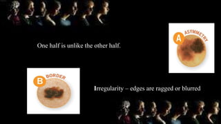 One half is unlike the other half.
Irregularity – edges are ragged or blurred
 