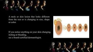 A mole or skin lesion that looks different
from the rest or is changing in size, shape
or color.
If you notice anything on your skin changing,
itching or bleeding,
see a board-certified dermatologist.
 