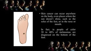 • Skin cancer can occur anywhere
on the body, even places where the
sun doesn’t shine, such as the
soles of the feet, or in the nose or
mouth.
In fact, in people of color
30 to 40% of melanomas are
diagnosed on the bottom of the
foot.
 