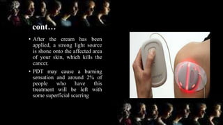 cont…
• After the cream has been
applied, a strong light source
is shone onto the affected area
of your skin, which kills the
cancer.
• PDT may cause a burning
sensation and around 2% of
people who have this
treatment will be left with
some superficial scarring
 