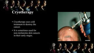 Cryotherapy
• Cryotherapy uses cold
treatment to destroy the
cancer.
• It is sometimes used for
non-melanoma skin cancers
in their early stages.
 
