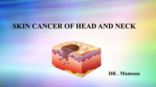 SKIN CANCER OF HEAD AND NECK
DR . Mamoon
 