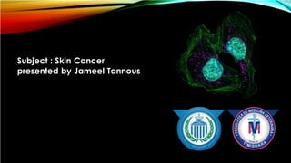 Subject : Skin Cancer
presented by Jameel Tannous
 