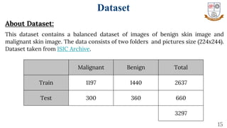 15
About Dataset:
This dataset contains a balanced dataset of images of benign skin image and
malignant skin image. The data consists of two folders and pictures size (224x244).
Dataset taken from ISIC Archive.
Dataset
Malignant Benign Total
Train 1197 1440 2637
Test 300 360 660
3297
 