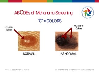 Skin cancer Risk, summary, types and treatment | PDF