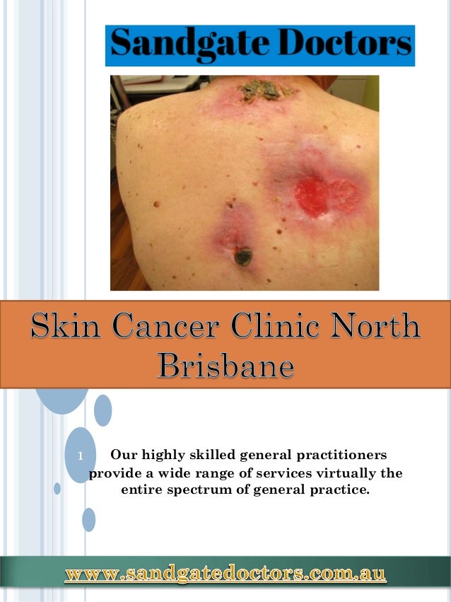 skin cancer clinic near me