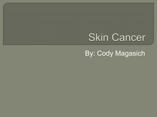 Skin Cancer By: Cody Magasich 