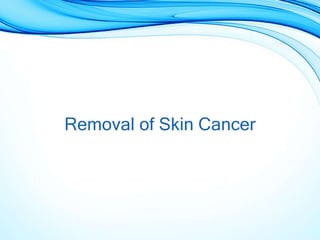 Removal of Skin Cancer
 