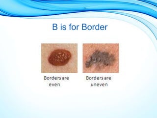 B is for Border
 