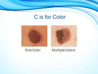 C is for Color
 