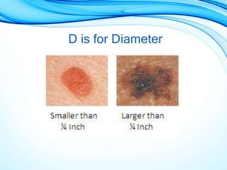 D is for Diameter
 