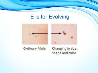 E is for Evolving
 