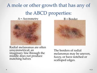 SKIN CANCER - BUGEMA UNIVERSITY. | PPTX