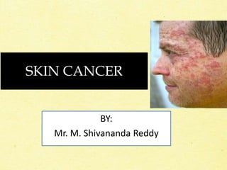 SKIN CANCER
BY:
Mr. M. Shivananda Reddy
 