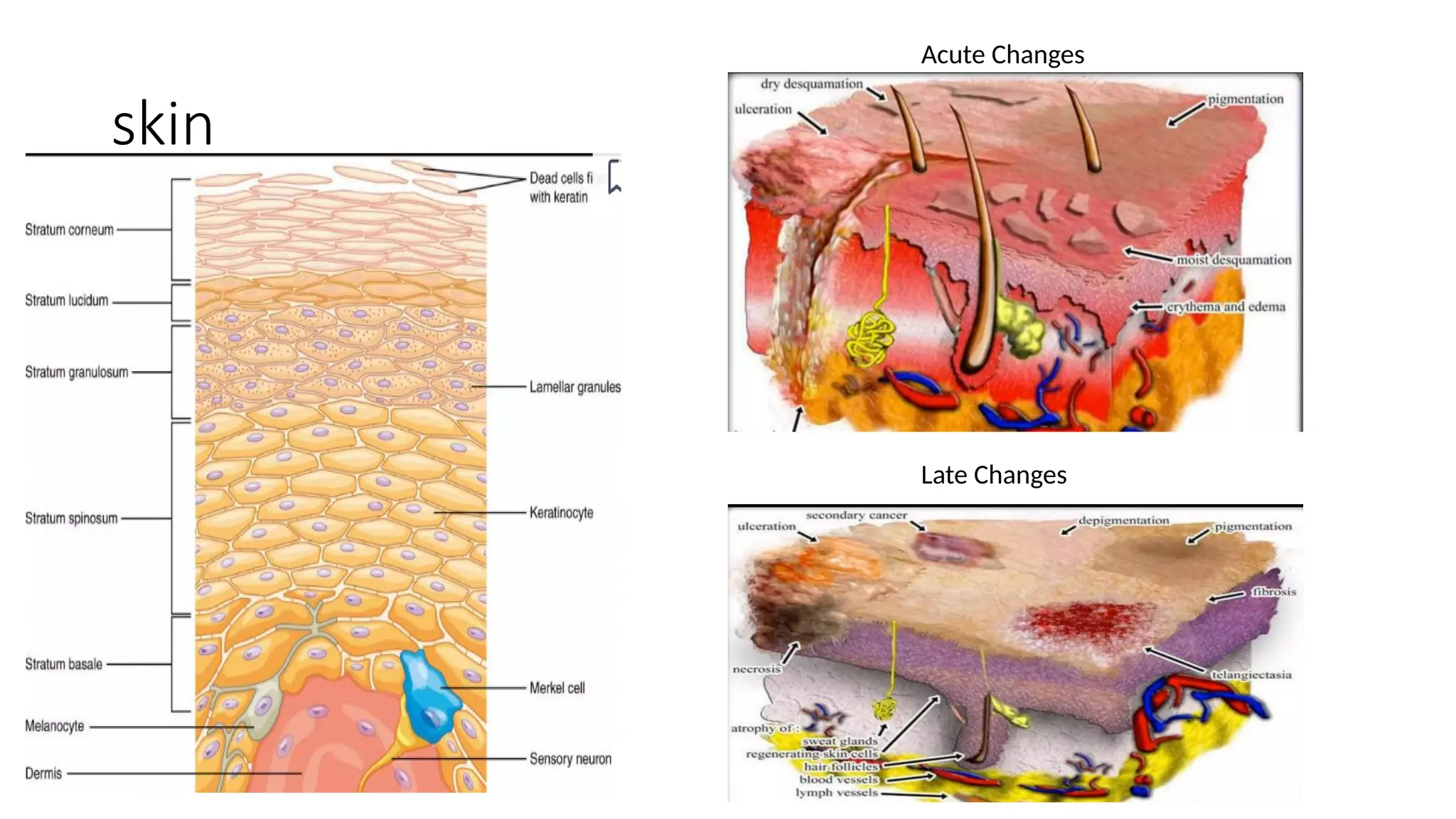 Skin care duringthe RadiationTherapy.pptx