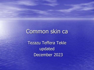 Common skin ca
Tezazu Teffera Tekle
updated
December 2023
 