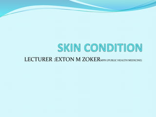 LECTURER :EXTON M ZOKERMPH (PUBLIC HEALTH MEDICINE)
 