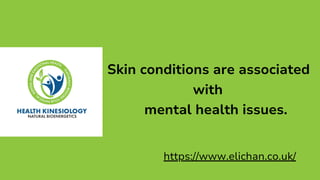 Skin conditions are associated with mental health issues.