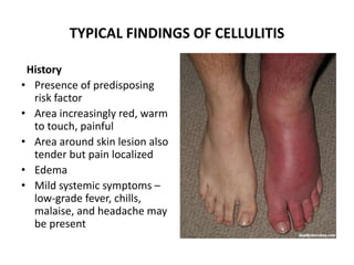 Skin conditions of surgical Importance.pptx