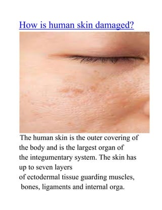 How is human skin damaged?
The human skin is the outer covering of
the body and is the largest organ of
the integumentary system. The skin has
up to seven layers
of ectodermal tissue guarding muscles,
bones, ligaments and internal orga.
 