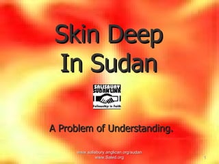 www.salisbury.anglican.org/sudan www.Saled.org Skin Deep In Sudan ,[object Object]