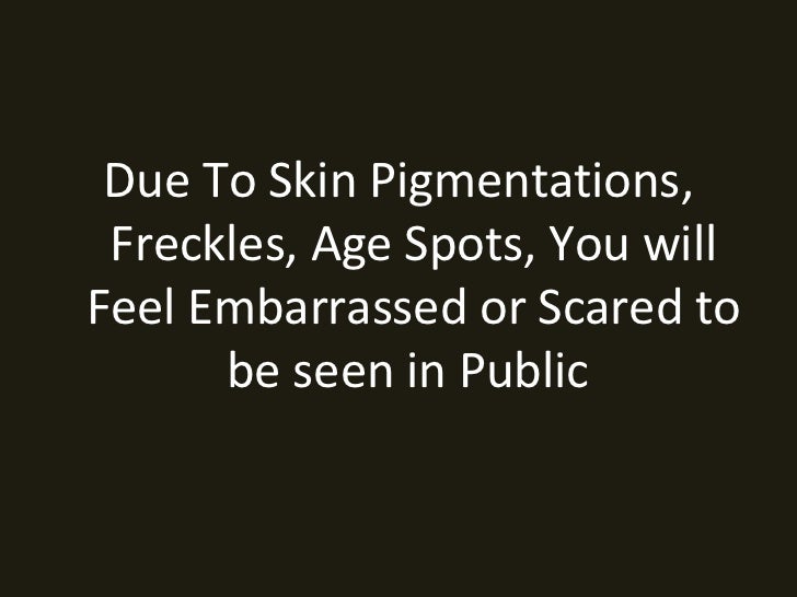 Skin discoloration on neck