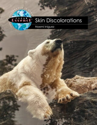 Noemi Iniguez
Skin Discolorations
 
