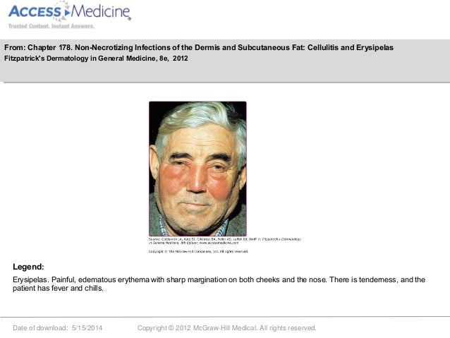 Skin disease for internist slideshare