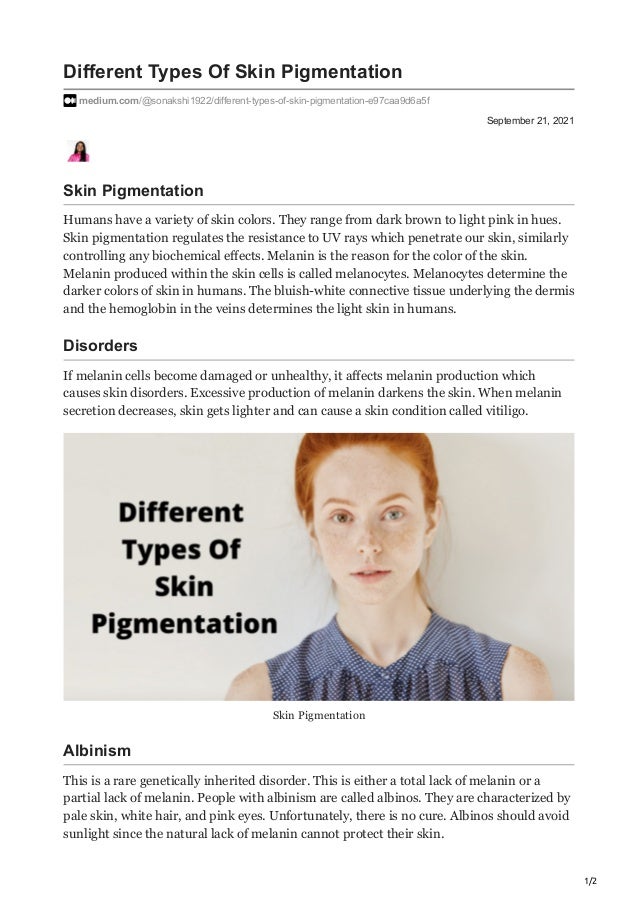 Skindiseasehospital different types of skin pigmentation