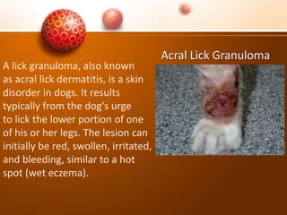 Acral Lick Granuloma
A lick granuloma, also known
as acral lick dermatitis, is a skin
disorder in dogs. It results
typically from the dog's urge
to lick the lower portion of one
of his or her legs. The lesion can
initially be red, swollen, irritated,
and bleeding, similar to a hot
spot (wet eczema).
 