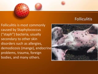 Folliculitis
Folliculitis is most commonly
caused by Staphylococcus
(“staph”) bacteria, usually
secondary to other skin
disorders such as allergies,
demodicosis (mange), endocrine
problems, trauma, foreign
bodies, and many others.
 