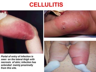 Skin disease ppt for nursing student | PPTX
