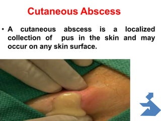 Skin disease ppt for nursing student | PPTX