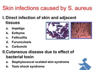 Skin Infection Color Skin disease ppt for nursing student | PPTX