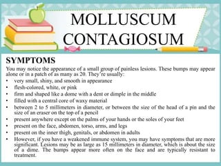 MOLLUSCUM
CONTAGIOSUM
SYMPTOMS
You may notice the appearance of a small group of painless lesions. These bumps may appear
alone or in a patch of as many as 20. They’re usually:
• very small, shiny, and smooth in appearance
• flesh-colored, white, or pink
• firm and shaped like a dome with a dent or dimple in the middle
• filled with a central core of waxy material
• between 2 to 5 millimeters in diameter, or between the size of the head of a pin and the
size of an eraser on the top of a pencil
• present anywhere except on the palms of your hands or the soles of your feet
• present on the face, abdomen, torso, arms, and legs
• present on the inner thigh, genitals, or abdomen in adults
• However, if you have a weakened immune system, you may have symptoms that are more
significant. Lesions may be as large as 15 millimeters in diameter, which is about the size
of a dime. The bumps appear more often on the face and are typically resistant to
treatment.
 