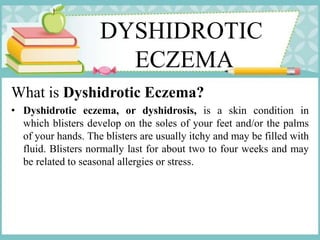 DYSHIDROTIC
ECZEMA
What is Dyshidrotic Eczema?
• Dyshidrotic eczema, or dyshidrosis, is a skin condition in
which blisters develop on the soles of your feet and/or the palms
of your hands. The blisters are usually itchy and may be filled with
fluid. Blisters normally last for about two to four weeks and may
be related to seasonal allergies or stress.
 