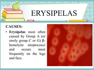 ERYSIPELAS
CAUSES:
• Erysipelas most often
caused by Group A (or
rarely group C or G) β-
hemolytic streptococci
and occurs most
frequently on the legs
and face.
 