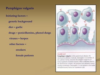 Pemphigus vulgaris
Initiating factors –
genetic background
diet – garlic
drugs – penicillamine, phenol durgs
viruses – herpes
other factors –
smokers
female patients
 